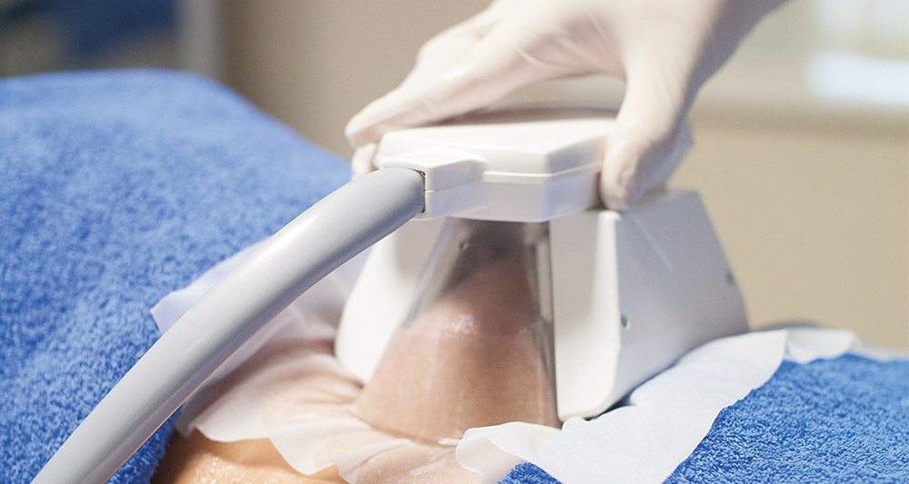 How Fat Freezing and HIFU Work Together? 2 Multiple Areas in One Session HIFU and Fat Freezing Northamptonshire