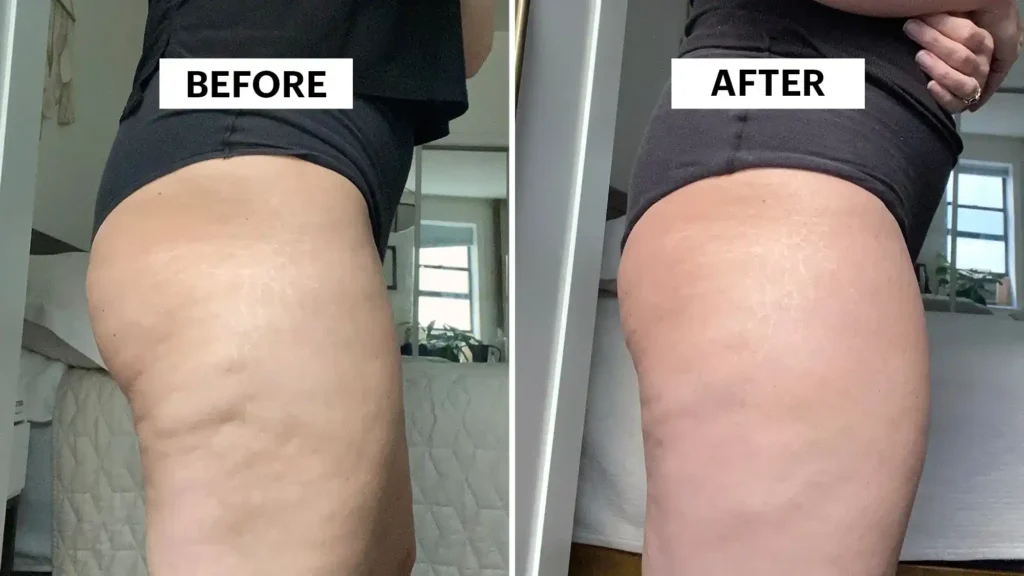 Do Toning Exercise Northamptonshire Really Tackle Cellulite?